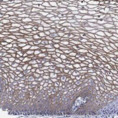 Immunohistochemistry-Paraffin: Airway Trypsin-like Protease/HAT/TMPRSS11D Antibody [NBP3-17648]