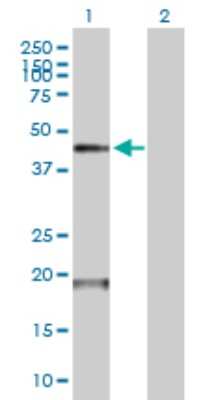 Western Blot: Airway Trypsin-like Protease/HAT/TMPRSS11D Antibody [H00009407-B01P]