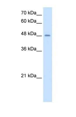 Western Blot: Airway Trypsin-like Protease/HAT/TMPRSS11D Antibody [NBP1-62545]