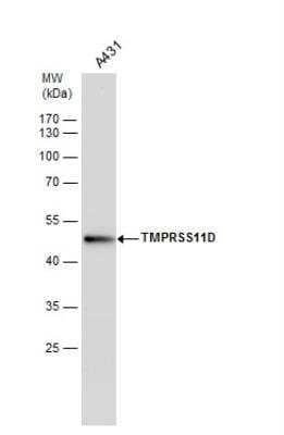 Western Blot: Airway Trypsin-like Protease/HAT/TMPRSS11D Antibody [NBP2-20668]