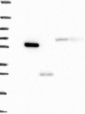 Western Blot: Airway Trypsin-like Protease/HAT/TMPRSS11D Antibody [NBP3-17648]