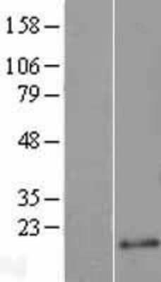 Western Blot: Ajuba Overexpression Lysate [NBL1-12114]