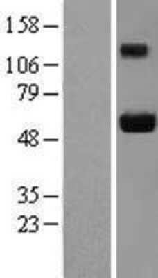 Western Blot: Ajuba Overexpression Lysate [NBL1-12115]