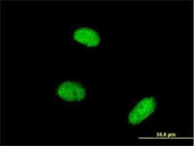 Immunocytochemistry/ Immunofluorescence: Akirin2 Antibody (3D9) [H00055122-M01]