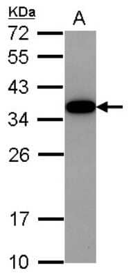 Western Blot: Akirin2 Antibody [NBP2-15320]