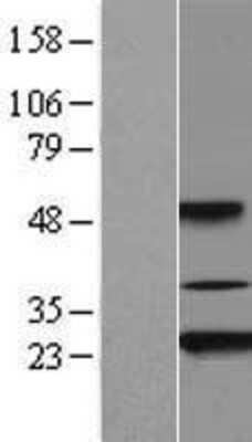 Western Blot: Akirin2 Overexpression Lysate [NBL1-07431]