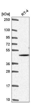 Western Blot: AKT2 Antibody [NBP2-55812]