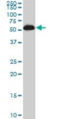 Western Blot: AKT3 Antibody (3F3) [H00010000-M03]