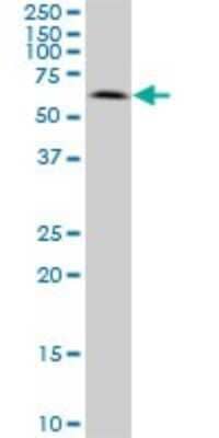 Western Blot: AKT3 Antibody (6E11) [H00010000-M08]