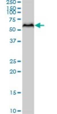 Western Blot: AKT3 Antibody (6E11) [H00010000-M08]