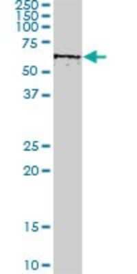 Western Blot: AKT3 Antibody (6E11) [H00010000-M08]