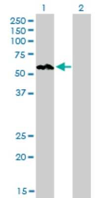 Western Blot: AKT3 Antibody (6E11) [H00010000-M08]