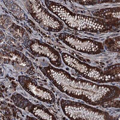 Immunohistochemistry-Paraffin: Alanyl tRNA synthetase Antibody [NBP1-87414]