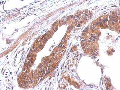 Immunohistochemistry-Paraffin: Alanyl tRNA synthetase Antibody [NBP2-15332]