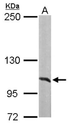 Western Blot: Alanyl tRNA synthetase Antibody [NBP1-31706]