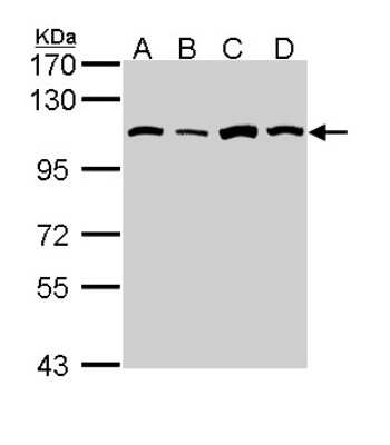 Western Blot: Alanyl tRNA synthetase Antibody [NBP1-31706]