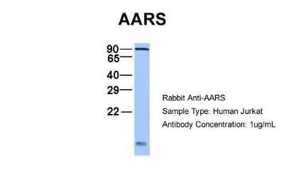 Western Blot: Alanyl tRNA synthetase Antibody [NBP1-57136]