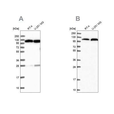 Western Blot: Alanyl tRNA synthetase Antibody [NBP1-87414]