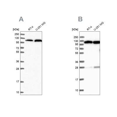 Western Blot: Alanyl tRNA synthetase Antibody [NBP2-58166]