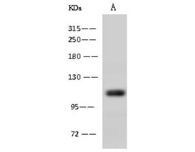 Western Blot: Alanyl tRNA synthetase Antibody [NBP2-97723]