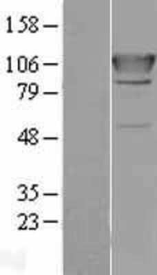 Western Blot: Alanyl tRNA synthetase Overexpression Lysate [NBL1-07165]