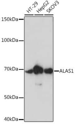 Western Blot: Alas1 Antibody (2K1G3) [NBP3-16487]