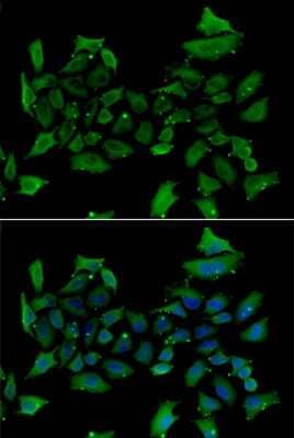 Immunocytochemistry/ Immunofluorescence: Alas1 Antibody - BSA Free [NBP3-04580]