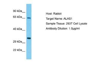 Western Blot: Alas1 Antibody [NBP2-86973]