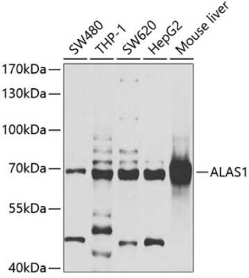 Western Blot: Alas1 AntibodyBSA Free [NBP2-92476]