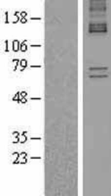 Western Blot: Alas1 Overexpression Lysate [NBL1-07446]