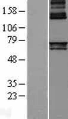 Western Blot: Alas1 Overexpression Lysate [NBL1-07447]