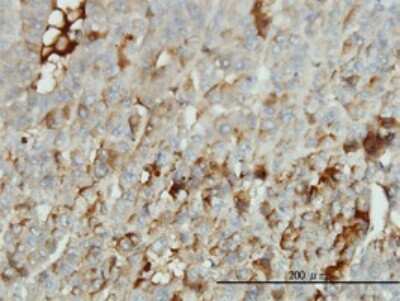 Immunohistochemistry-Paraffin: Albumin Antibody (1G12-1B3) [H00000213-M01]