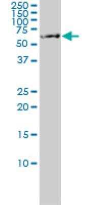 Western Blot: Albumin Antibody (1G12-1B3) [H00000213-M01]