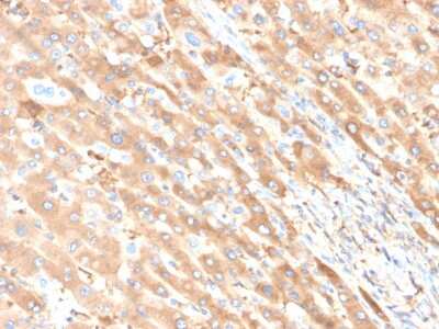 Immunohistochemistry-Paraffin: Albumin Antibody (ALB/6411R) - Azide and BSA Free [NBP3-08917]