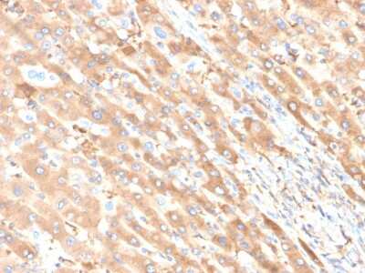 Immunohistochemistry-Paraffin: Albumin Antibody (ALB/6411R) [NBP3-07174]