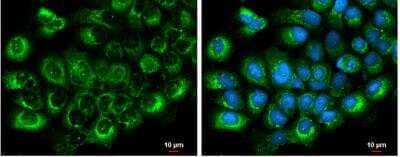 Immunocytochemistry/ Immunofluorescence: Albumin Antibody [NBP1-32458]