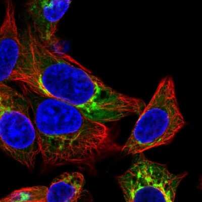 Immunocytochemistry/ Immunofluorescence: Albumin Antibody [NBP2-38174]