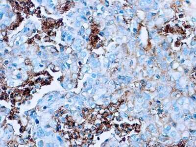 Immunohistochemistry-Paraffin: Albumin Antibody [NB600-570]