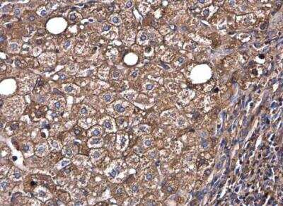 Immunohistochemistry-Paraffin: Albumin Antibody [NBP1-32458]