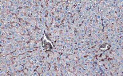 Immunohistochemistry-Paraffin: Albumin Antibody [NBP1-32458]