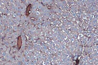 Immunohistochemistry-Paraffin: Albumin Antibody [NBP1-32458]