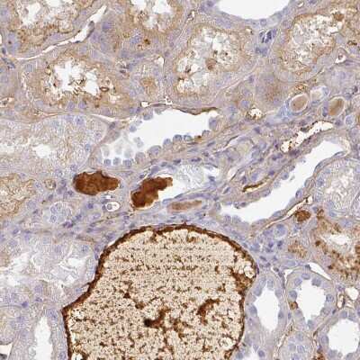Immunohistochemistry-Paraffin: Albumin Antibody [NBP2-38174]