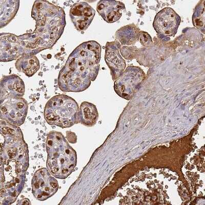 Immunohistochemistry-Paraffin: Albumin Antibody [NBP2-38174]