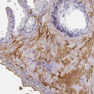 Immunohistochemistry-Paraffin: Albumin Antibody [NBP2-38174]