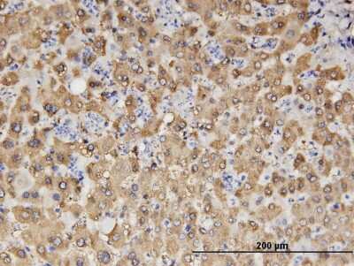Immunohistochemistry-Paraffin: Aldehyde Dehydrogenase 1-A1/ALDH1A1 Antibody (1G6) [H00000216-M05]