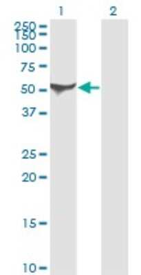 Western Blot: Aldehyde Dehydrogenase 1-A1/ALDH1A1 Antibody (1G6) [H00000216-M05]