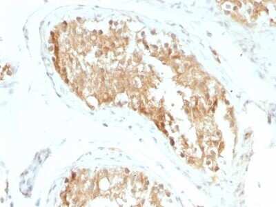 Immunohistochemistry-Paraffin: Aldehyde Dehydrogenase 1-A1/ALDH1A1 Antibody (ALDH1A1/1381) - Azide and BSA Free [NBP2-54422]