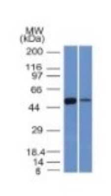 Western Blot: Aldehyde Dehydrogenase 1-A1/ALDH1A1 Antibody (ALDH1A1/1381)Azide and BSA Free [NBP2-54422]