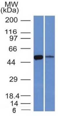 Western Blot: Aldehyde Dehydrogenase 1-A1/ALDH1A1 Antibody (ALDH1A1/1381) [NBP2-53248]