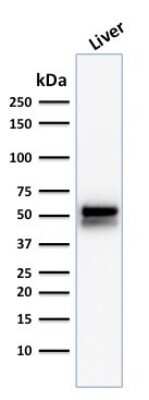 Western Blot: Aldehyde Dehydrogenase 1-A1/ALDH1A1 Antibody (ALDH1A1/1381) [NBP2-53248]